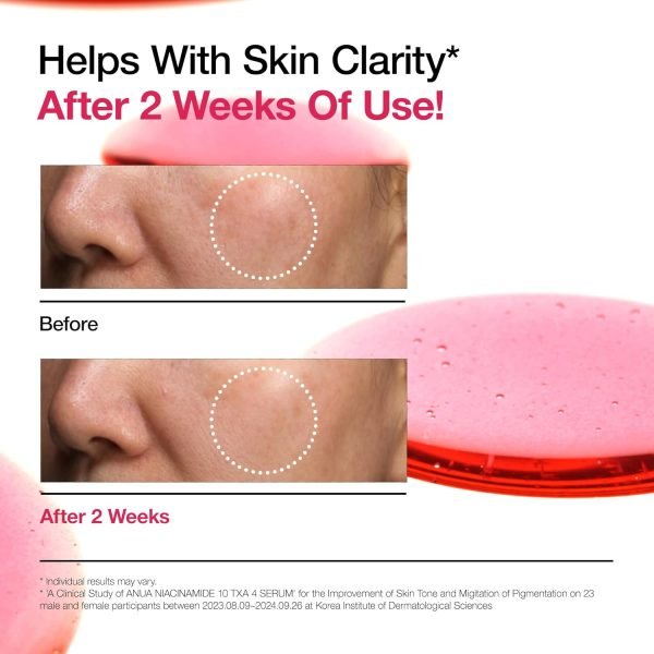Anua Niacinamide 10% + TXA 4% Serum (30ml) - Image 4