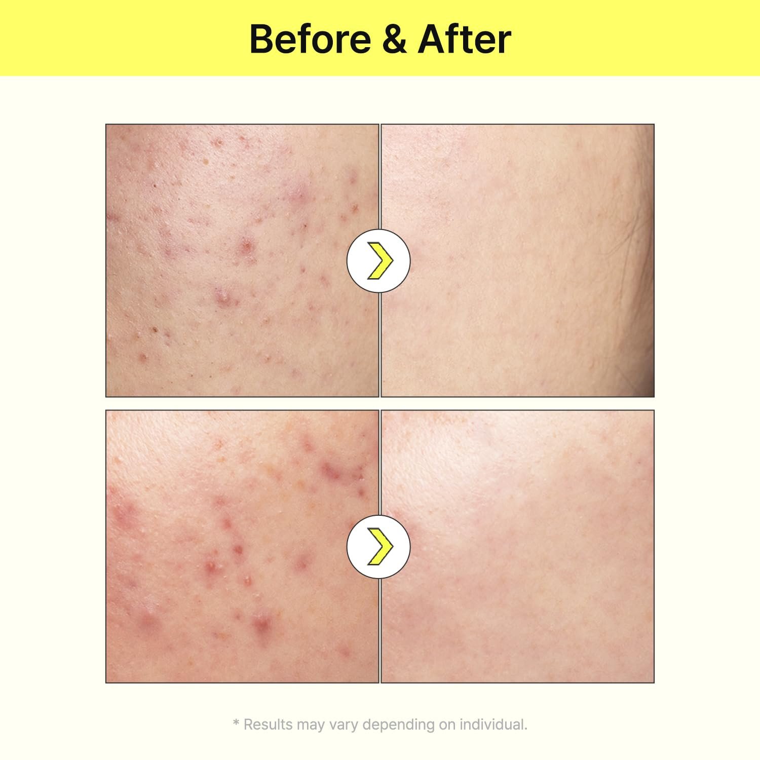 TIAM Vita B3 Source Serum-(40ml) - Image 4