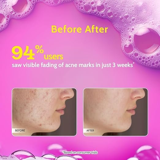 Chemist At Play 2% Salicylic Acid Face Wash for Oily & Acne-Prone Skin-100ml - Image 4