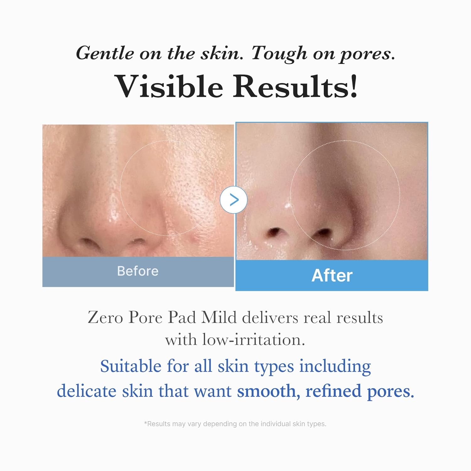 Medicube Toner Pads Zero Pore Pad Mild 2.0-(155g) - Image 4