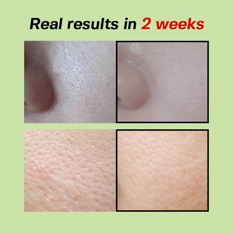SUNGBOON EDITOR Green Tomato Pore Lifting Ampoule-30ml - Image 6