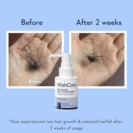 WishCare Hair Growth Serum Concentrate-30ml - Image 2